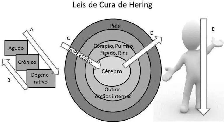 Leis de Cura de Hering